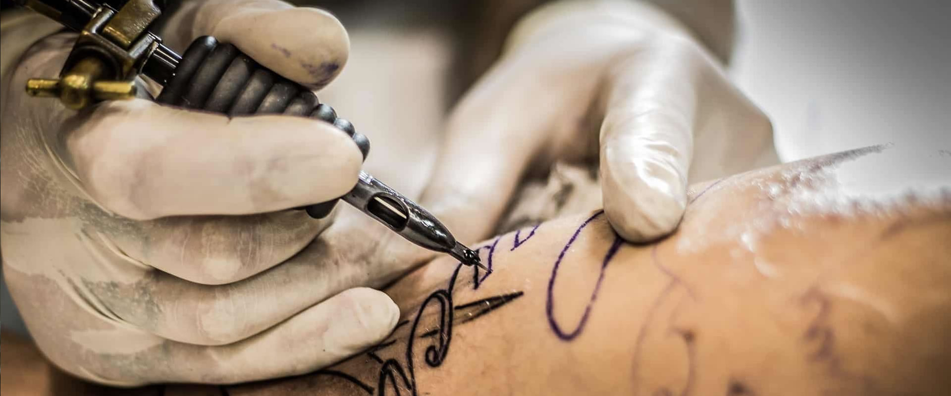 Tattooentfernung Mit Laser Gabler Hendel